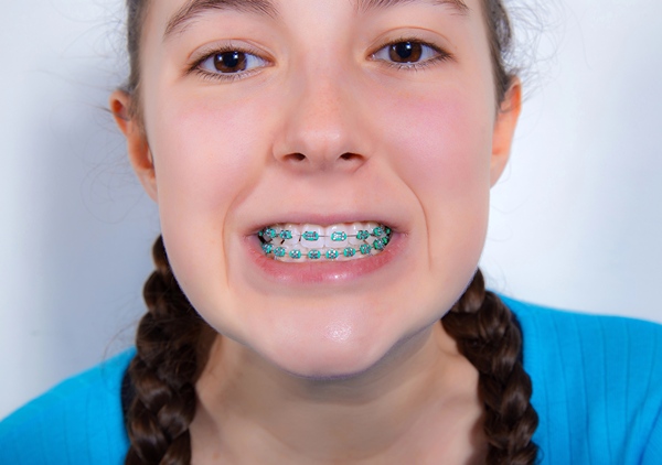 Teen girl showing off her braces.