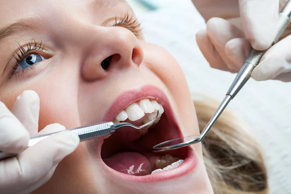 Close up of a girl in dentist's chair with mouth wide open.